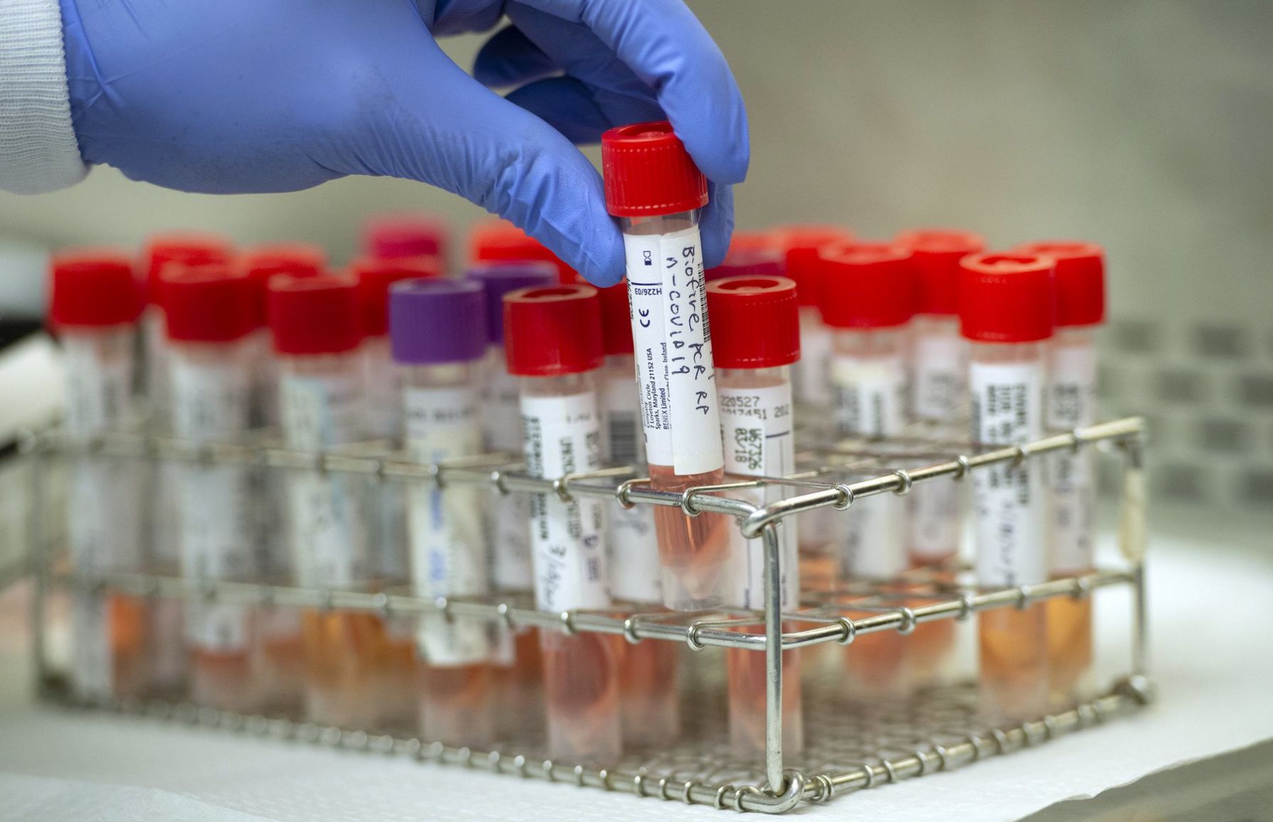Coronavirus test tube samples